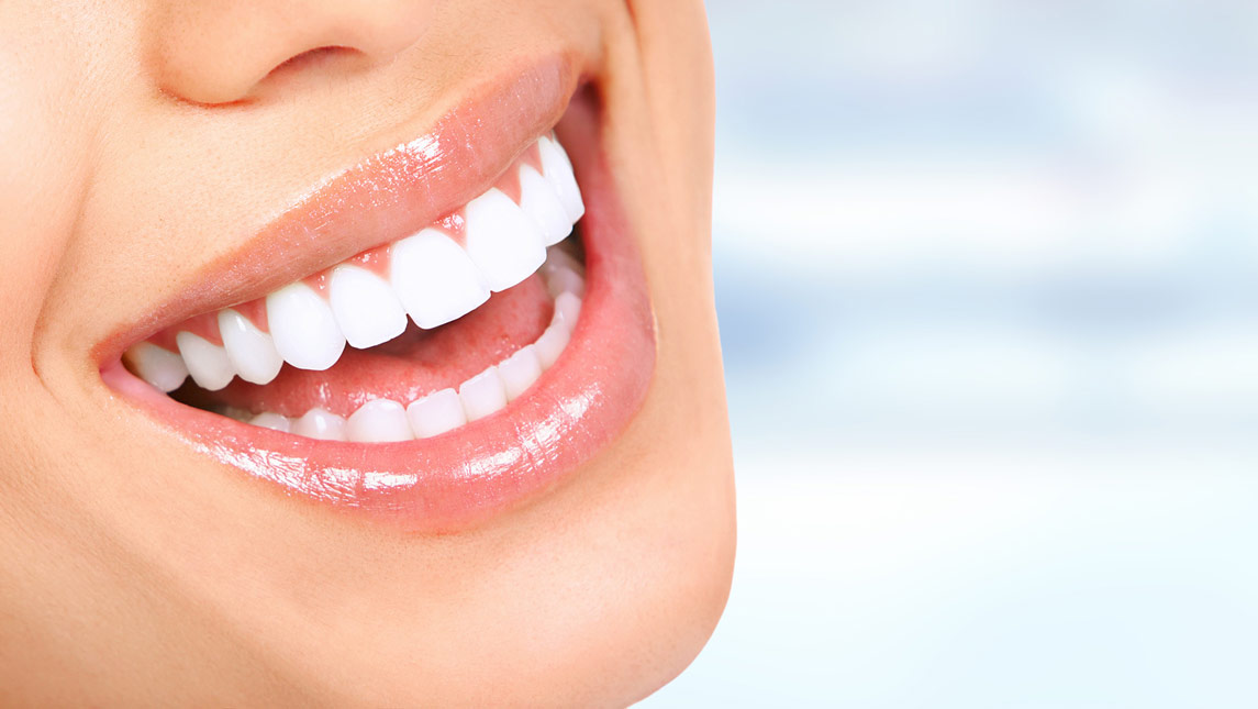 smileZERO Premium Zahnaufhellung
