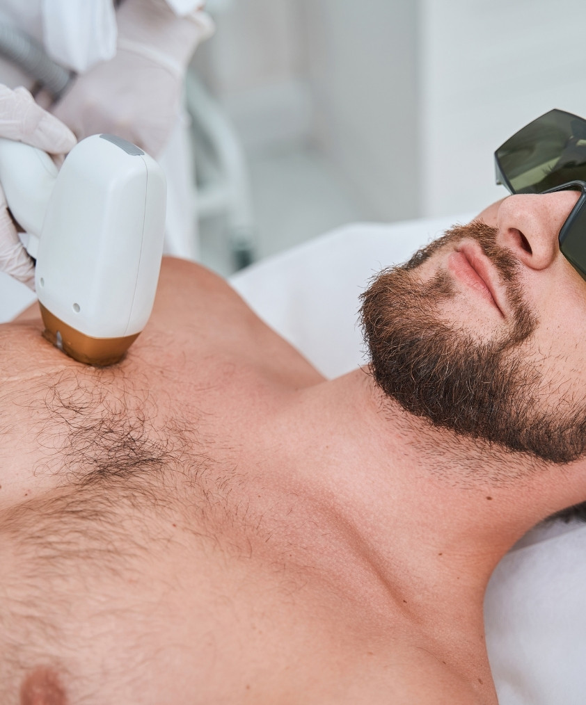 Premium Diodenlaser Haarentfernung Behandlung
